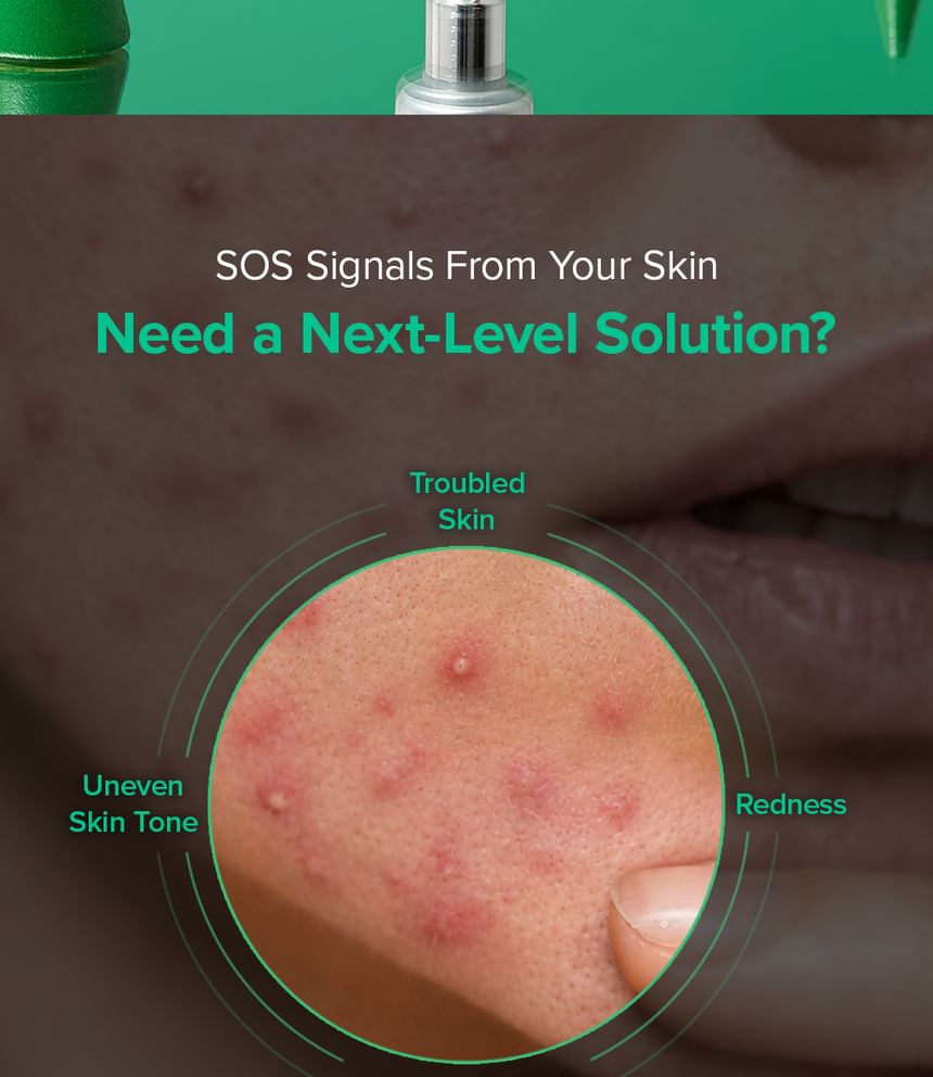 Mary & May Spicule Azelaic PDRN Spot Cream
